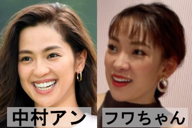 【比較画像】中村アンと似てる芸能人は７人！新木優子やフワちゃんに激似？